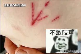 头皮发麻！蟑螂居然还会咬人？网友：蟑螂不会咬人，但它在吃人图片