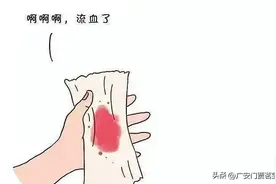 大便出鲜血但不疼，这是怎么回事呢?图片