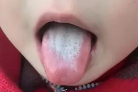 孩子积食内热，大山楂丸VS保和丸，首选哪个？图片