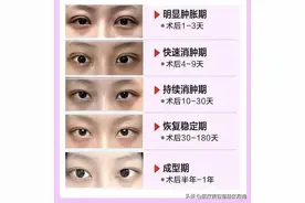 双眼皮术后偷偷变美指南这5件事做对了，消肿快还自然！图片