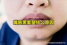 嘴唇黑紫是什么原因图片