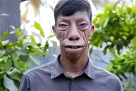 印尼“马脸一家”：因父亲基因太强大，5个兄弟姐妹4个“马脸”图片