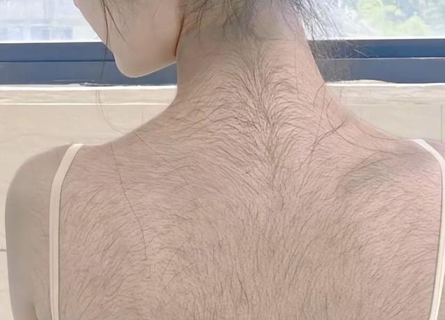 好男一身毛，好女一身膘？医生：有一定科学道理