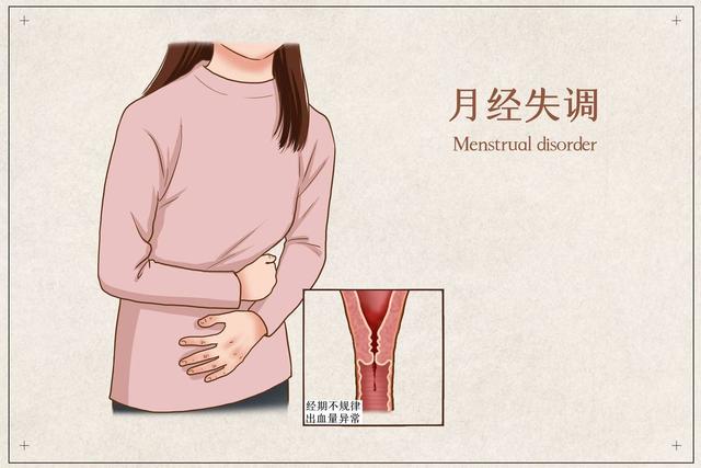 月经不调是宫寒惹的祸？提醒：若伴随这6种表现，要及时就医