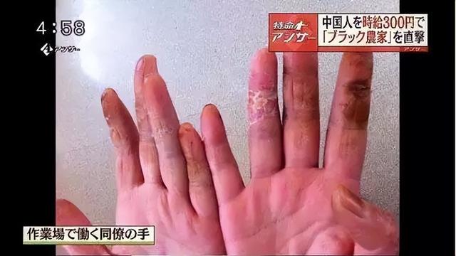 毒打、性骚扰，比缅北更像人间地狱，35万研修生沦为现代奴隶