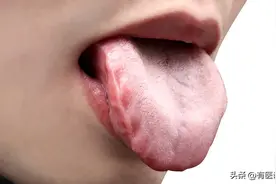 舌头一白，阳气喊停！身体发出的求救信号你读懂了吗？图片