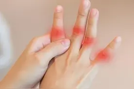 手指关节疼，是咋回事儿？多半与4种病因有关，早知早安心图片