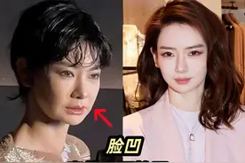 比“发腮”更可怕的是“脸凹”，明明脸瘦了，却更显老态，你是吗图片