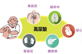 尿酸高的人，有哪些能吃，哪些不能吃？图片