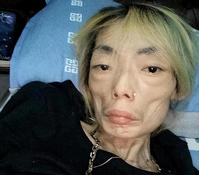 豪门玩物，几年被折磨成牙齿全脱落，不足80斤，似骷髅，惨不忍睹
