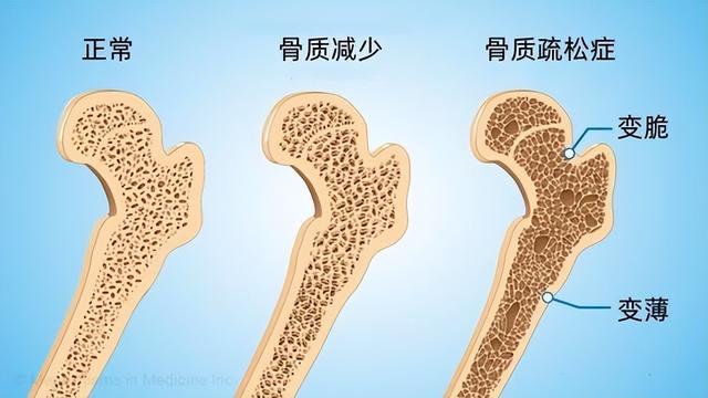 寿命长不长，牙齿先知？65岁后，掉牙多的人活得久？告诉你答案