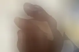 警惕！它苏醒了，大伯田间翻土被“偷袭！” 有医院去年一天接诊4例图片