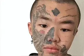 纹面男孩人生新篇章:洗去纹身重拾光明图片