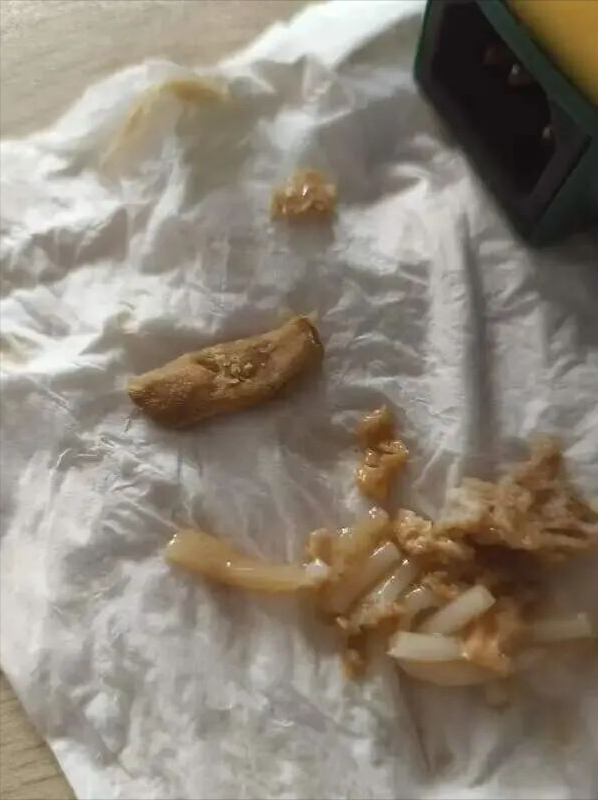 恶心到想吐！热销品牌吃出趾甲、烟头？曾排销量榜第一，客服回应
