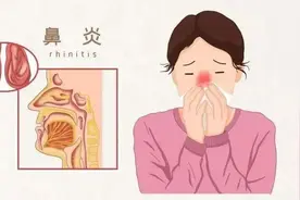 身弱孩子易被鼻炎缠，一个中成药“阳”过玉屏风，“暖”过小青龙图片
