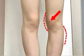 这是你的腿吗？腿不直其实是膝盖内侧鼓包在作祟！图片