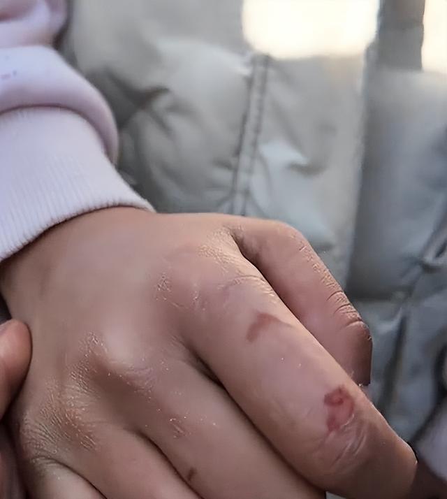 远离造神陷阱	，官媒揭开冰窟救人后李佳婷现状，令人担心的事发生