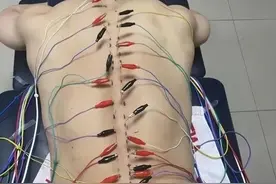 石智勇治腰伤扎的针装满5升水桶图片