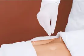 膝骨关节炎临床有何症状？中医针灸治疗有何优势，需要注意什么？图片