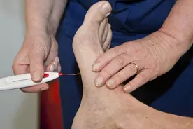 腿上出现3个表现，可能是糖尿病神经 病变！不要拖成糖尿病足图片