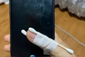 手腕疼，按鼠标、刷手机都变得费劲...你要警惕它来了图片