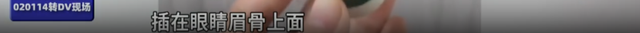 “杀伤力”如此惊人！上海人都喜欢的这项运动，已致多人受伤！插入眉骨、扎穿手指，凶器竟是