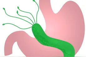 这类食物吃得越多，感染幽门螺杆菌的几率越大图片