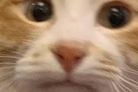 #健康素养提升V计划# 【近半月食欲下降、皮肤发黄......是得了什么怪病？？】图片