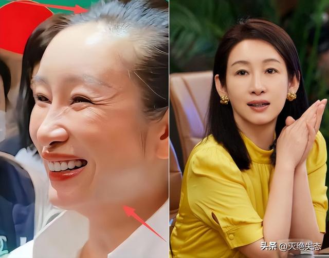 明星去掉滤镜后	，秦海璐“秃顶”，刘亦菲牙黄，宋祖英老到没认出