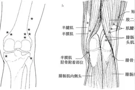 “伤筋动骨一百天”，是真的吗？图片