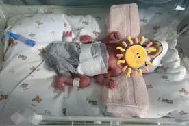 【妇幼科普】新生儿科 | 早产儿护理鸟巢式护理图片