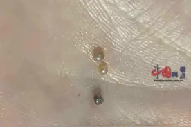 女子网购贻贝吃出多颗小珍珠：贻贝的品质很好，已经将珍珠收藏，感觉自己很幸运图片
