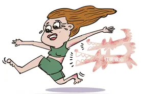 红斑狼疮有效医治成功率有多高？医生建议：中西医结合可协同增效图片