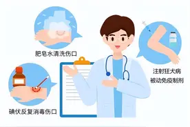被哪些动物咬了，需要打狂犬疫苗？暴露后第一时间应该……图片