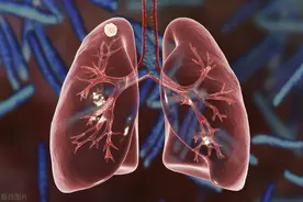 老祖宗留下的消痰散结名方，一攻一守，助力消散结节图片