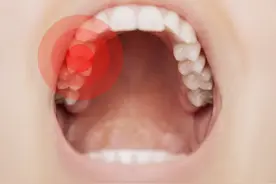 牙齿痛可能是这种病，别再认为是上火了图片