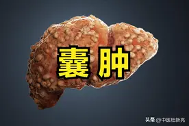 囊肿是什么原因造成的？老中医一针见血说出真相，奉上1个良方图片