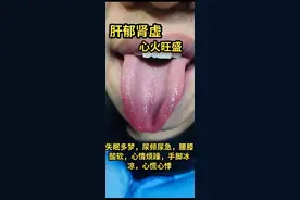 张医生舌诊实战分析——肾阳亏虚、心肝火旺、湿热下注！图片