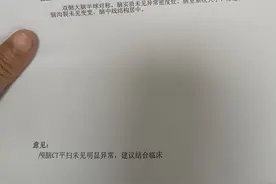 颈椎病图片