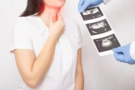 不同甲状腺疾病，到底该怎么忌口？图片