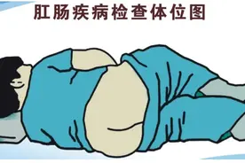 痔疮手术也能“无痛变轻松”？揭秘痔疮治疗的奇妙之旅！图片