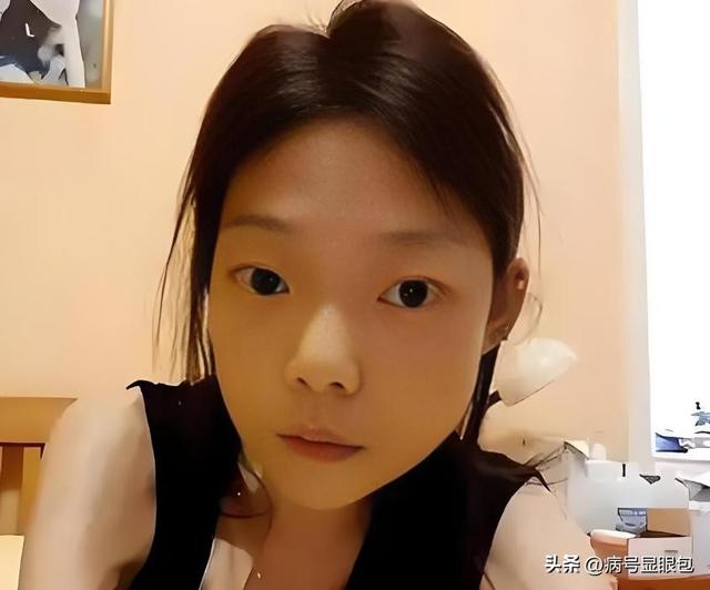 一代女神沦为豪门玩物？结婚8年牙齿全掉，器官切除，面似骷髅