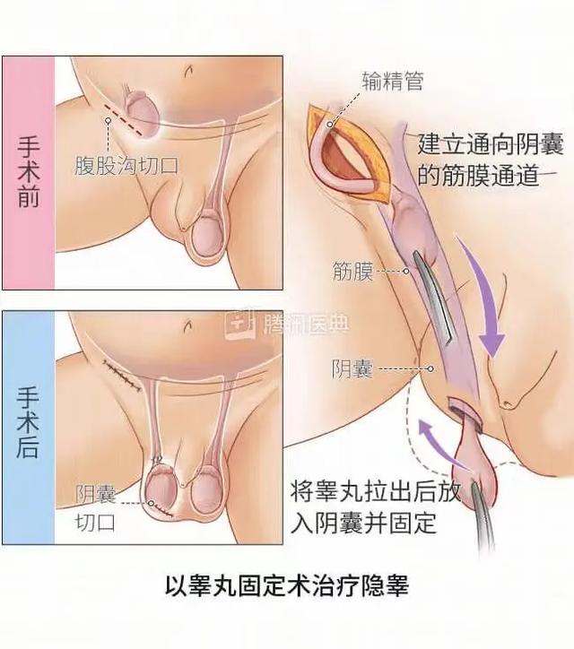 为什么男生的蛋蛋，摸摸更健康？（女生勿进）