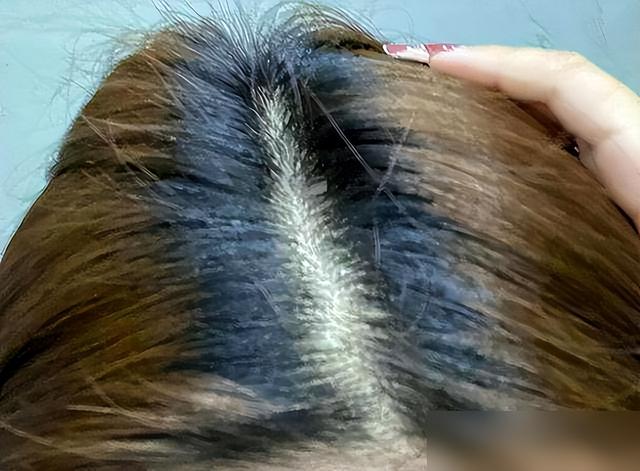 染发致癌是真的吗？哈佛大学调查11万人36年，结果终于揭晓了！