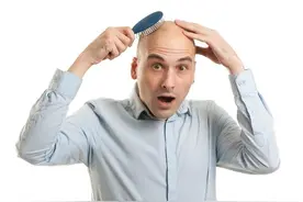 为什么有些人会秃顶？脱发的真正原因，预防和治疗这样做！图片