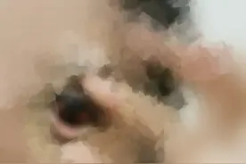 做完医美后眼球成黑红色，西安一女子维权三年多未果图片