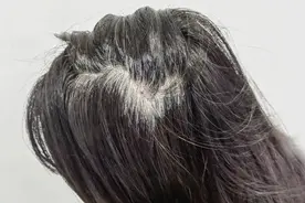 头上冒出白头发，你最该做的事情只有一件！图片