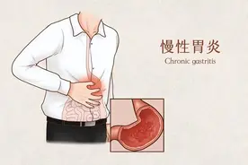 不吃就饿一吃就胀，身体越来越消瘦！3个中成药，脾胃慢慢养回来图片