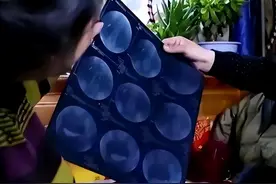 陕西女孩体检时意外发现左肾消失，怀疑遭医院偷切，真相如何？图片