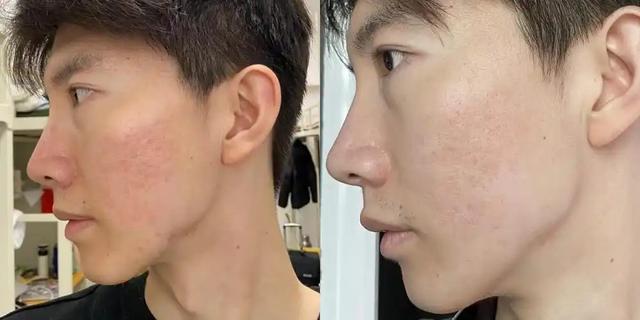 医生发现:男性若长期不喝酒,用不了多长时间,身体或有7大改变